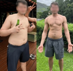 Antes e depois — paciente 1