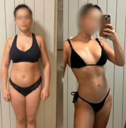Antes e depois — paciente 2