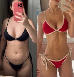 Antes e depois — paciente 3