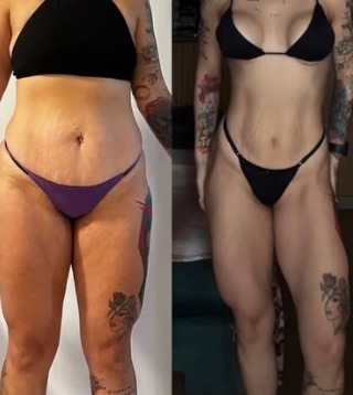 Antes e depois — paciente 5
